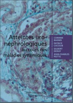 ATTEINTES URO-NEPHROLOGIQUES AU COURS DES MALADIES SYSTEMIQUES