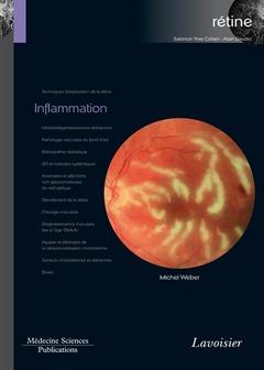 INFLAMMATION (VOLUME 4 - COFFRET RETINE)