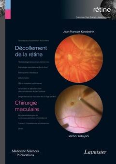 DECOLLEMENT DE LA RETINE / CHIRURGIE MACULAIRE (VOLUME 6 - COFFRET RETINE)