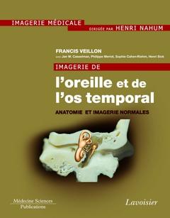 IMAGERIE DE L'OREILLE ET DE L'OS TEMPORAL - VOLUME 1. ANATOMIE ET IMAGERIE NORMALES