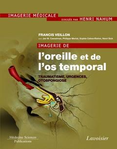 IMAGERIE DE L'OREILLE ET DE L'OS TEMPORAL - VOLUME 3. TRAUMATOLOGIE, URGENCES, OTOSPONGIOSE