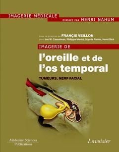 IMAGERIE DE L'OREILLE ET DE L'OS TEMPORAL - VOLUME 4. TUMEURS, NERF FACIAL