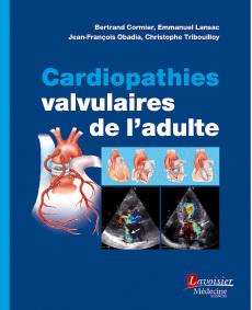 CARDIOPATHIES VALVULAIRES DE L'ADULTE