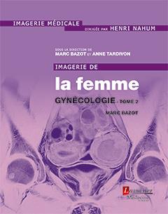 IMAGERIE DE LA FEMME : GYNECOLOGIE - TOME 2