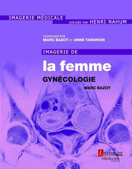 IMAGERIE DE LA FEMME : GYNECOLOGIE - TOME 1