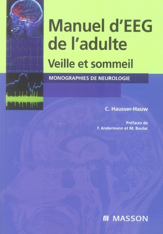 MANUEL D'EEG DE L'ADULTE - VEILLE ET SOMMEIL