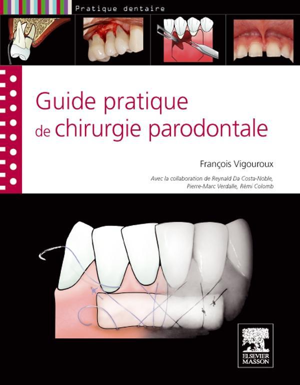 GUIDE PRATIQUE DE CHIRURGIE PARODONTALE