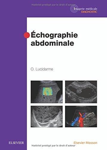 ECHOGRAPHIE ABDOMINALE