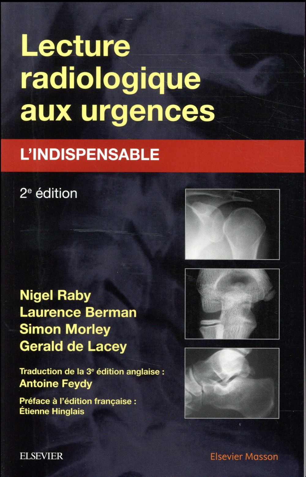 LECTURE RADIOLOGIQUE AUX URGENCES : L'INDISPENSABLE