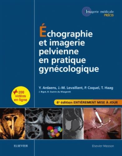 ECHOGRAPHIE ET IMAGERIE PELVIENNE EN PRATIQUE GYNECOLOGIQUE