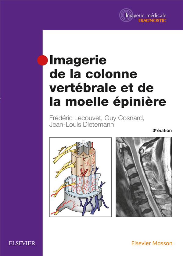 IMAGERIE DE LA COLONNE VERTEBRALE ET DE LA MOELLE EPINIERE