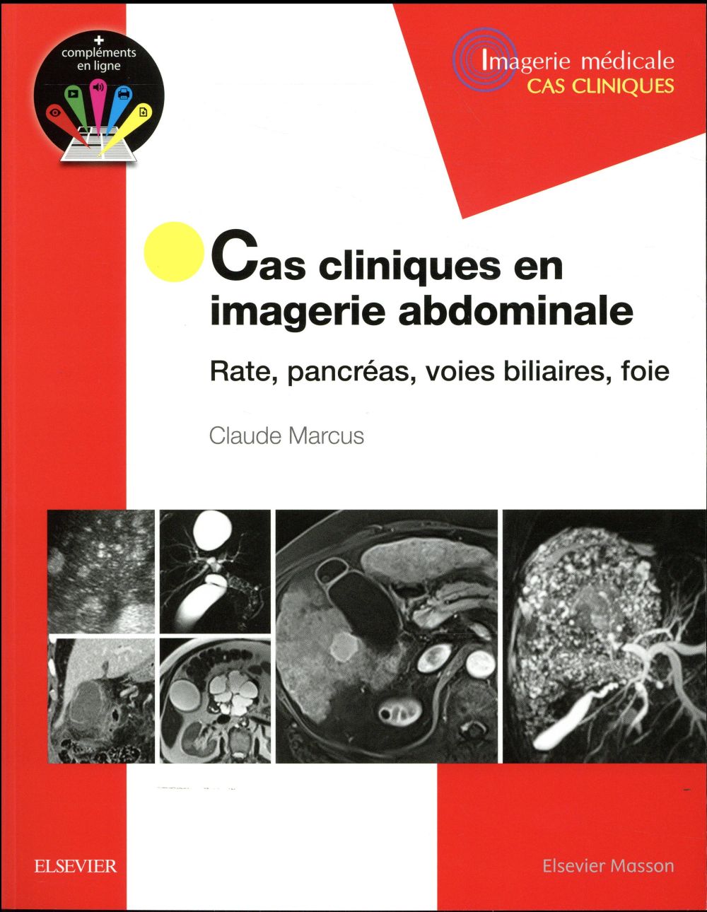 CAS CLINIQUES EN IMAGERIE ABDOMINALE - RATE, PANCREAS, VOIES BILIAIRES, FOIE