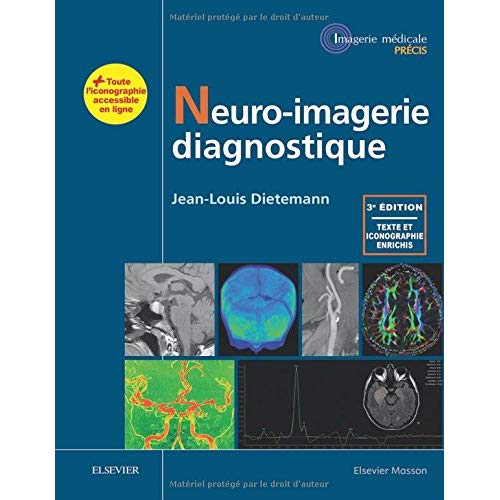 NEURO-IMAGERIE DIAGNOSTIQUE