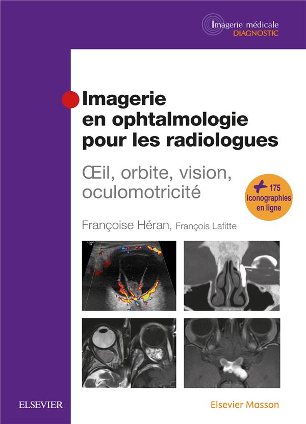 IMAGERIE EN OPHTALMOLOGIE POUR LES RADIOLOGUES - OEIL, ORBITE, VISION, OCULOMOTRICITE
