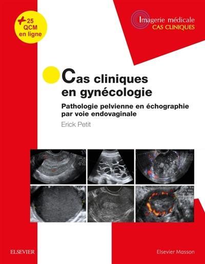 CAS CLINIQUES EN IMAGERIE : GYNECOLOGIE - PATHOLOGIE PELVIENNE EN ECHOGRAPHIE PAR VOIE ENDOVAGINALE