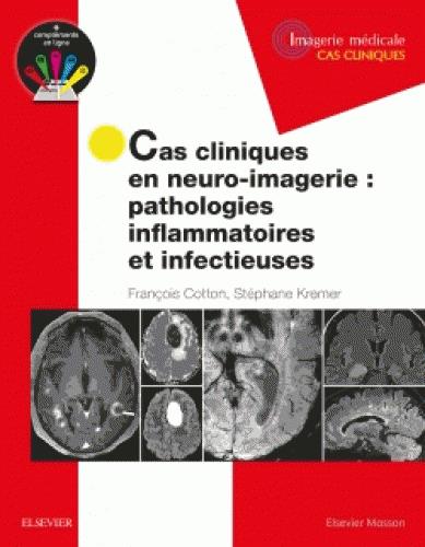 CAS CLINIQUES EN NEURO-IMAGERIE : PATHOLOGIES INFLAMMATOIRES ET INFECTIEUSES - PATH INFLAMMAT ET INF