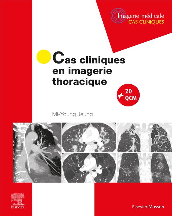 CAS CLINIQUES EN IMAGERIE THORACIQUE