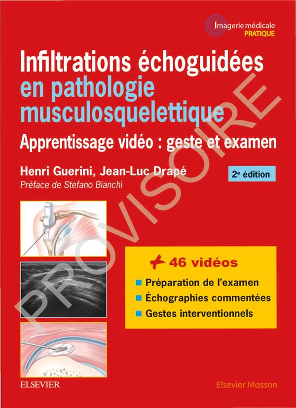 INFILTRATIONS ECHOGUIDEES EN PATHOLOGIE MUSCULOSQUELETTIQUE - APPRENTISSAGE VIDEO : GESTE ET EXAMEN