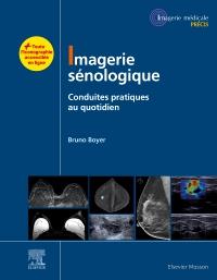 IMAGERIE SENOLOGIQUE - CONDUITES PRATIQUES AU QUOTIDIEN