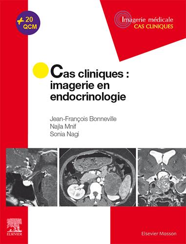 CAS CLINIQUES EN IMAGERIE : ENDOCRINOLOGIE