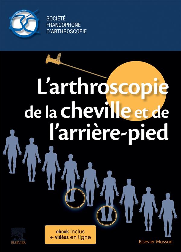 L'ARTHROSCOPIE DE LA CHEVILLE ET DE L'ARRIERE-PIED