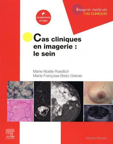 CAS CLINIQUES EN IMAGERIE : LE SEIN