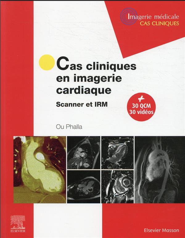 CAS CLINIQUES EN IMAGERIE CARDIAQUE - SCANNER ET IRM