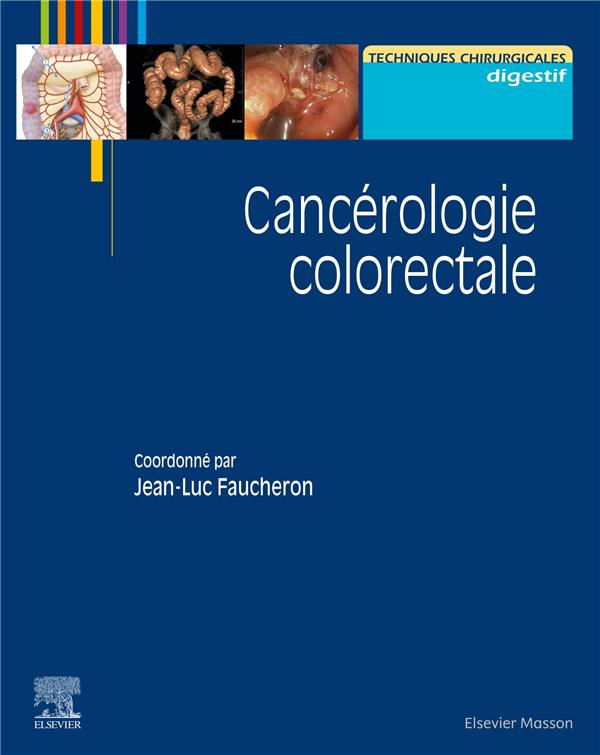 CANCEROLOGIE COLORECTALE