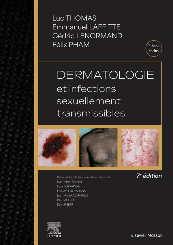 DERMATOLOGIE ET INFECTIONS SEXUELLEMENT TRANSMISSIBLES - AVEC EBOOK