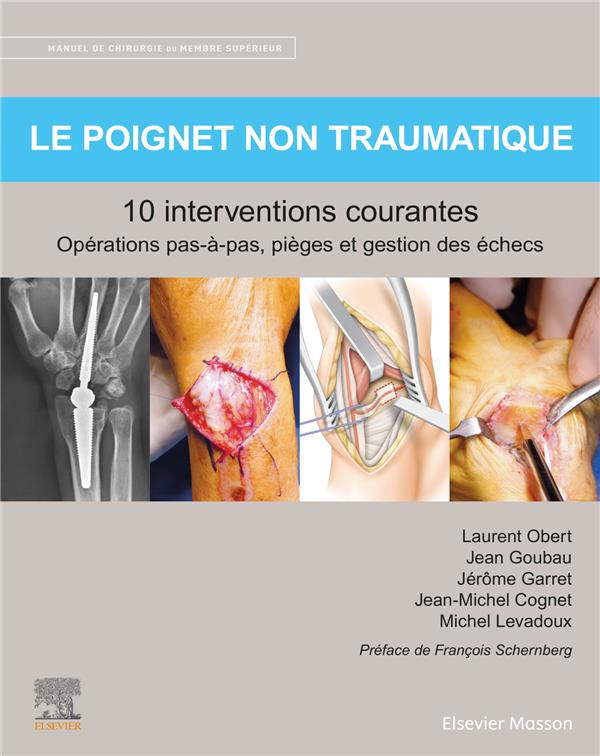 LE POIGNET NON TRAUMATIQUE 10 INTERVENTIONS COURANTES - MANUEL DE CHIRURGIE DU MEMBRE SUPERIEUR