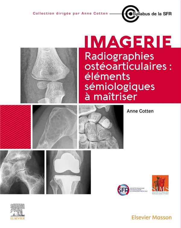 RADIOGRAPHIES OSTEOARTICULAIRES : ELEMENTS SEMIOLOGIQUES A MAITRISER