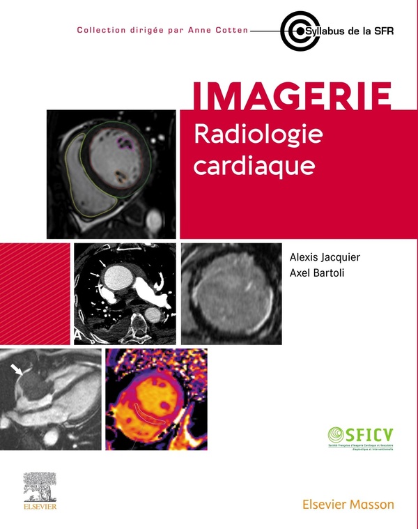RADIOLOGIE CARDIAQUE