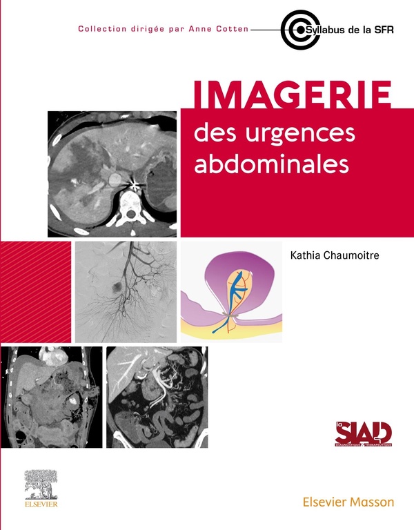 IMAGERIE DES URGENCES ABDOMINALES