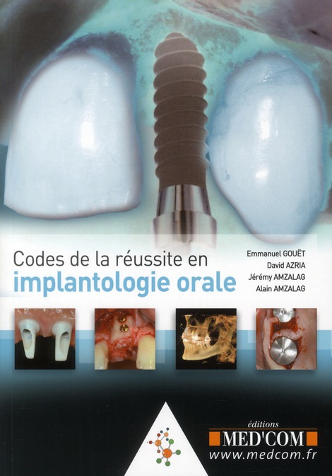 CODES DE LA REUSSITE EN IMPLANTOLOGIE ORALE