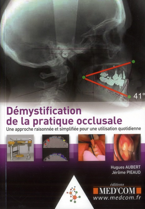 DEMYSTIFICTION DE LA PRATIQUE OCCLUSALE : UNEAPPROCHE RAISONNEE ET SIMPLIFIEE PO