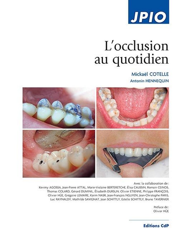 L'OCCLUSION AU QUOTIDIEN