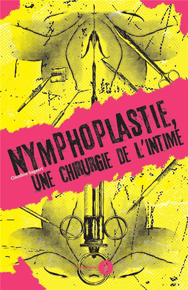 LA NYMPHOPLASTIE - UNE CHIRURGIE DE LA INTIME