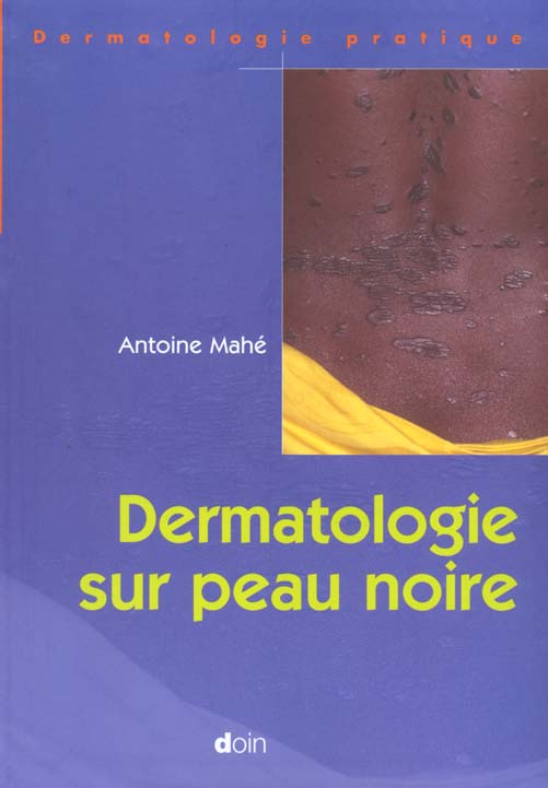 DERMATOLOGIE SUR PEAU NOIRE