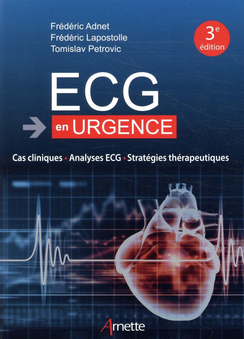 ECG EN URGENCE - CAS CLINIQUES - ANALYSES ECG - STRATEGIES THERAPEUTIQUES