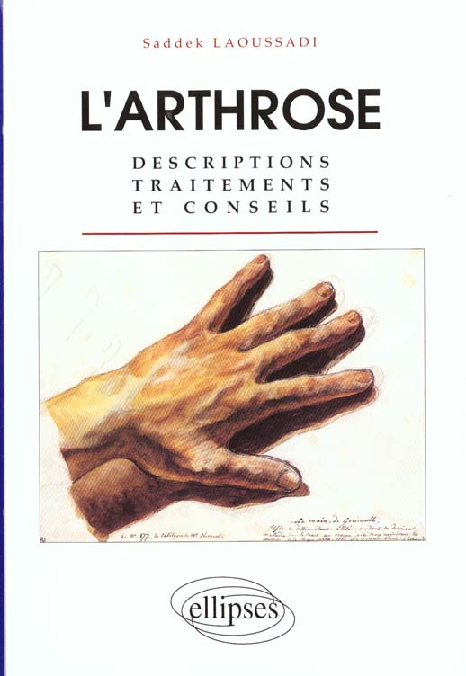 L'ARTHROSE