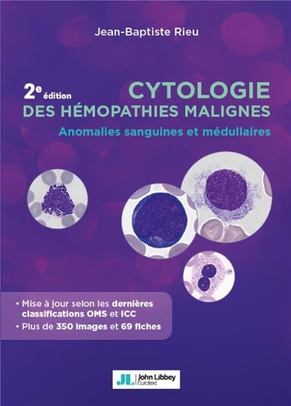 CYTOLOGIE DES HEMOPATHIES MALIGNES - ANOMALIES SANGUINES ET MEDULLAIRES