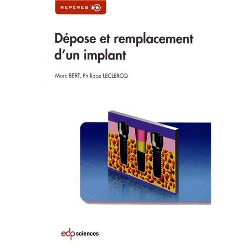 DEPOSE ET REMPLACEMENT D'UN IMPLANT