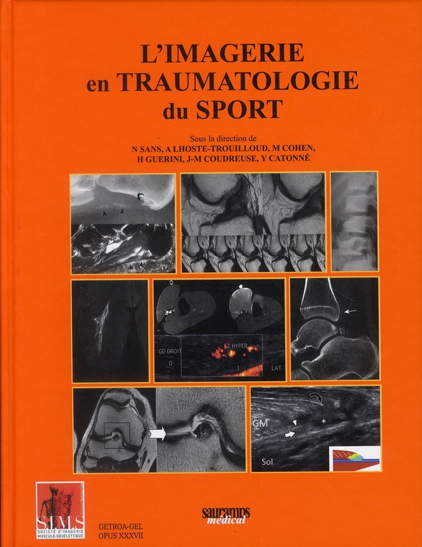L'IMAGERIE EN TRAUMATOLOGIE DU SPORT PHYSIOPATHOLOGIE DES LESIONS ET MODE DE CICATRISATION, REGION S