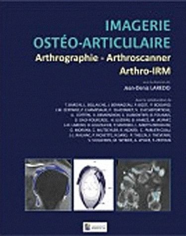 IMAGERIE OSTEO-ARTICULAIRE ARTHROGRAPHIE, ARTHROSCANNER, ARTHRO-IRM