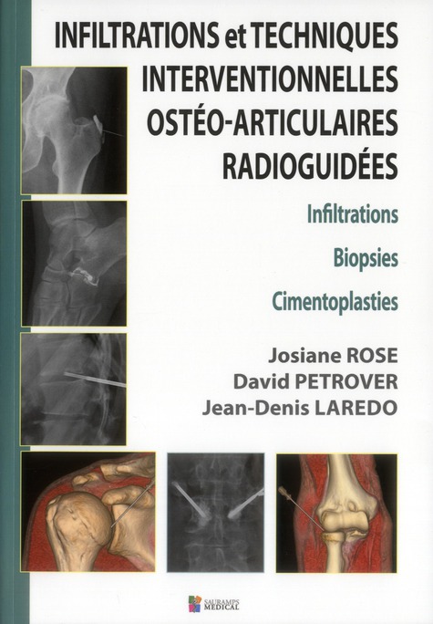 INFILTRATIONS ET TECHNIQUES INTERVENTIONNELLES OSTEO-ARTICULAIRES RADIOGUIDEES