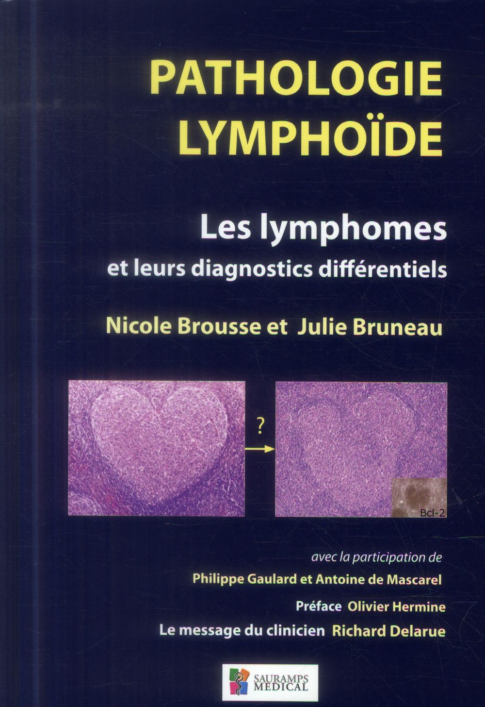 PATHOLOGIE LYMPHOIDE - LES LYMPHOMES ET LEURSDIAGNOCTICS DIFFERENTIELS