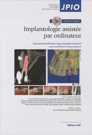 IMPLANTOLOGIE ASSISTEE PAR ORDINATEUR