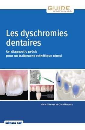 LES DYSCHROMIES DENTAIRES - UN DIAGNOSTIC PRECIS POUR UN TRAITEMENT ESTHETIQUE REUSSI