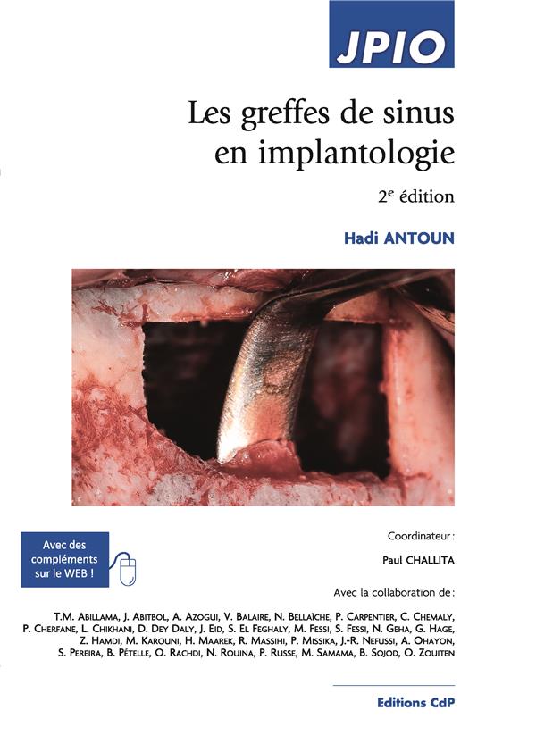 LES GREFFES DE SINUS EN IMPLANTOLOGIE - 2E EDITION