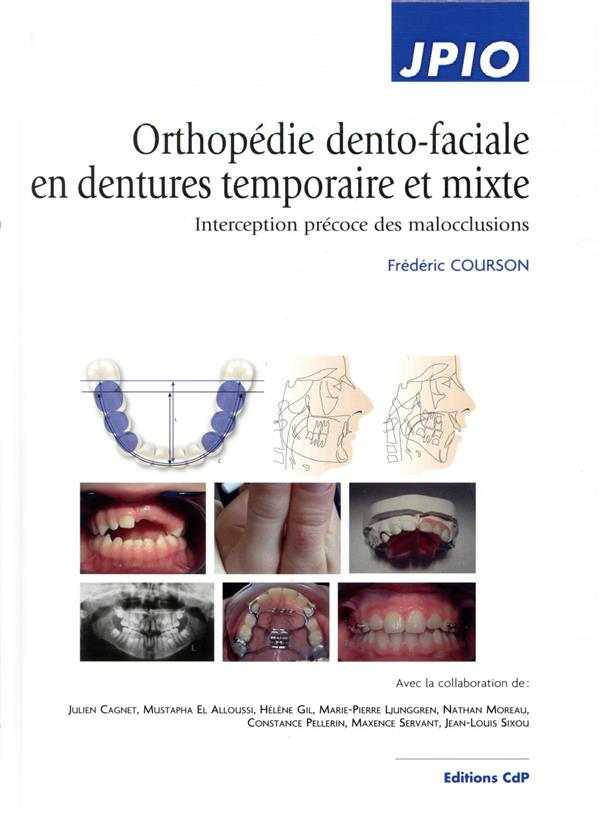 ORTHOPEDIE DENTO-FACIALE EN DENTURES TEMPORAIRE ET MIXTE - INTERCEPTION PRECOCE DES MALOCCLUSIONS